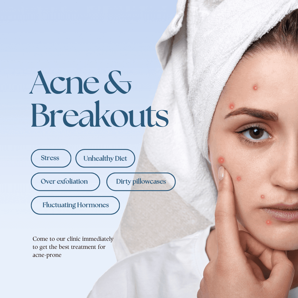 Acne & breakouts
