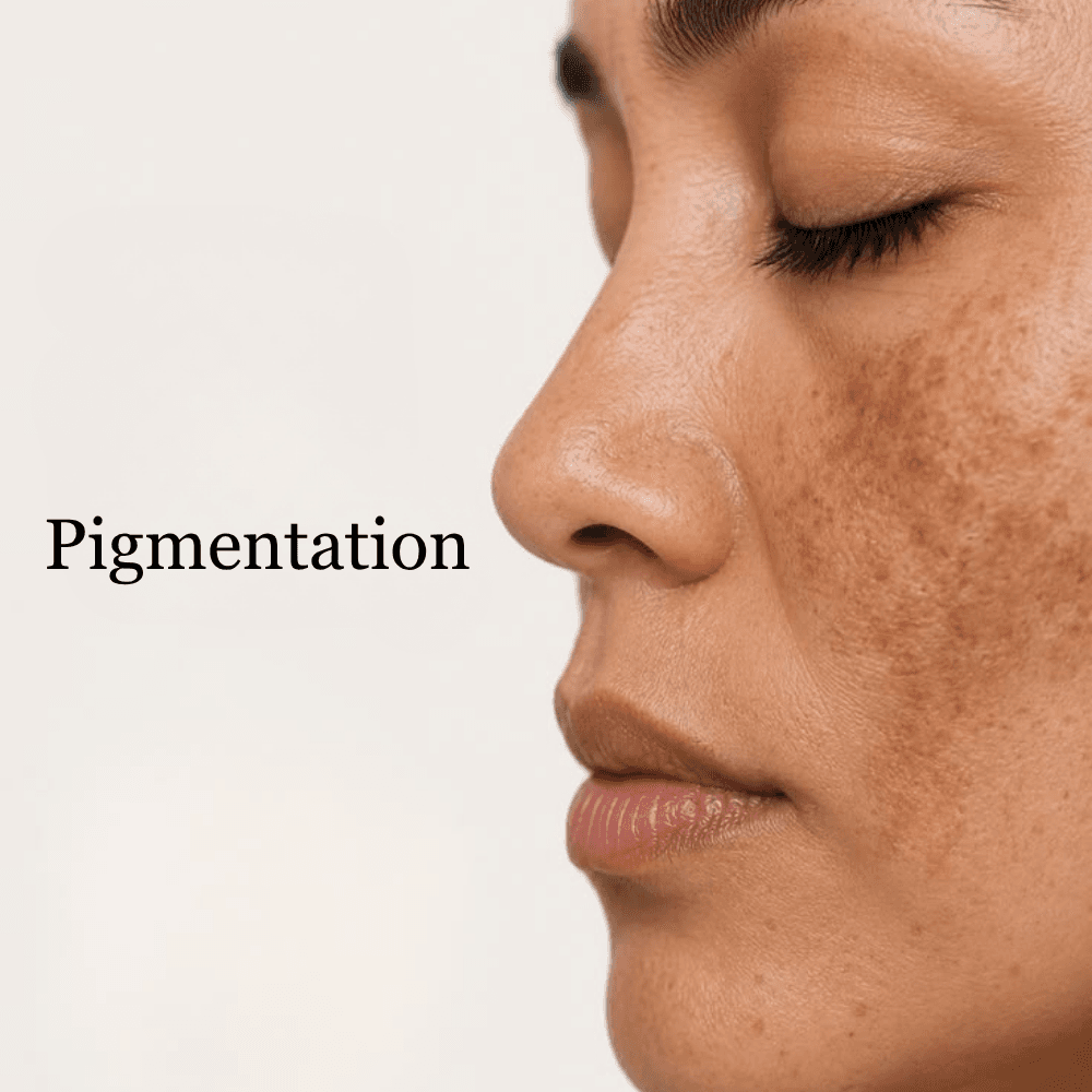 Pigmentation
