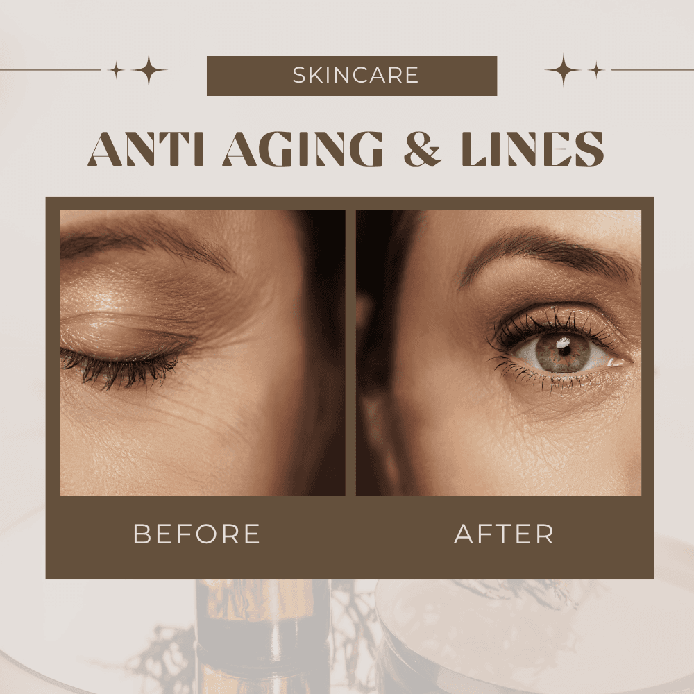 Anti-aging & lines